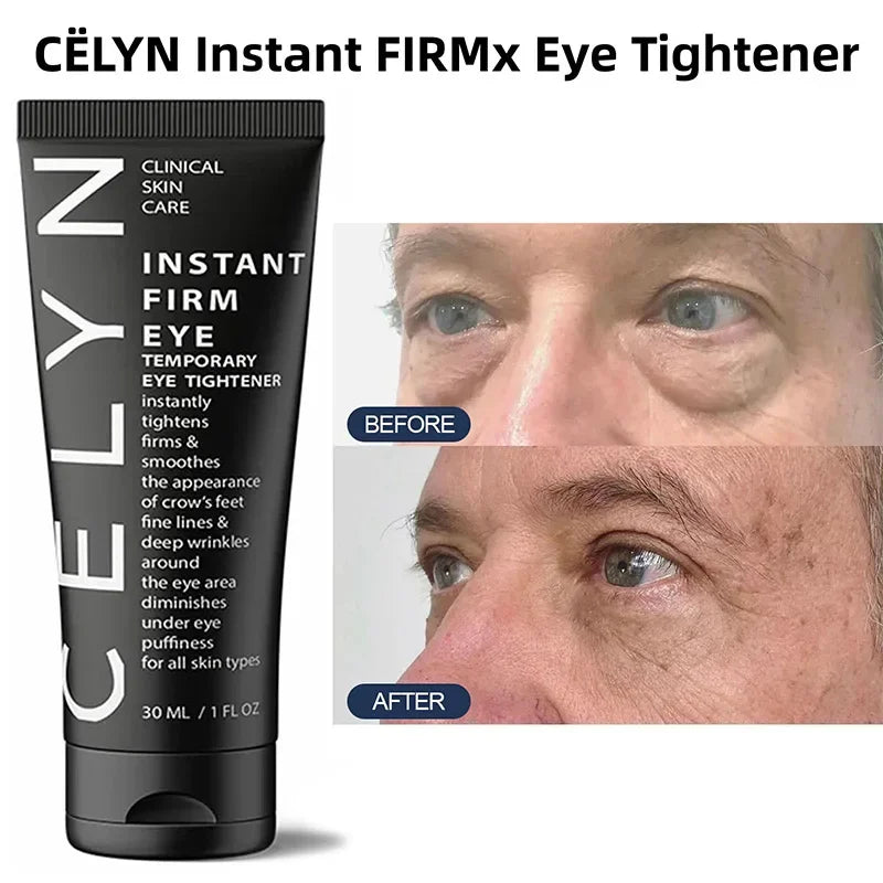1PC 30Ml CËLYN Instant Firm Eye Cream Eye Lifting Eye Bag Removal Wrinkle Removal Dark Circle Remover Eyes Skin Beauty Care